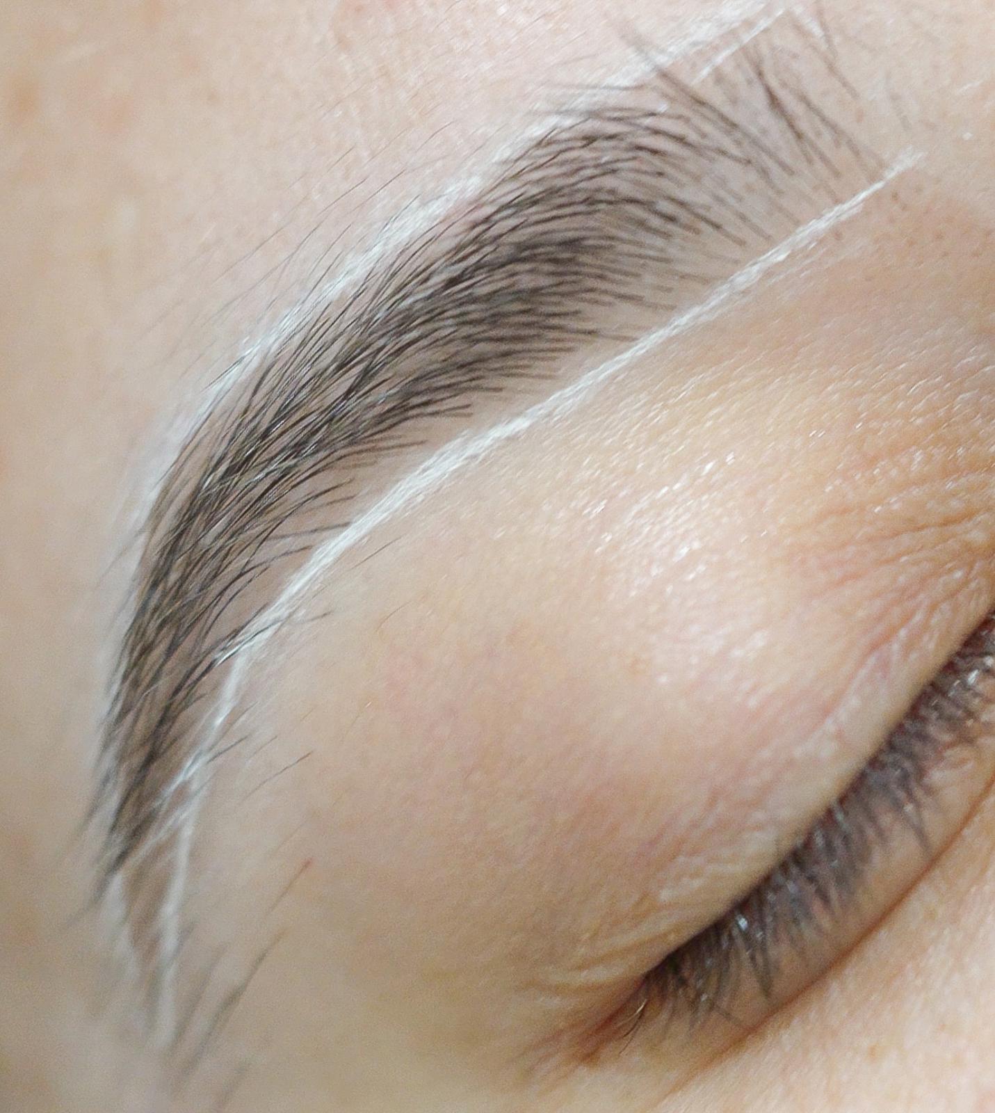 brow mapping